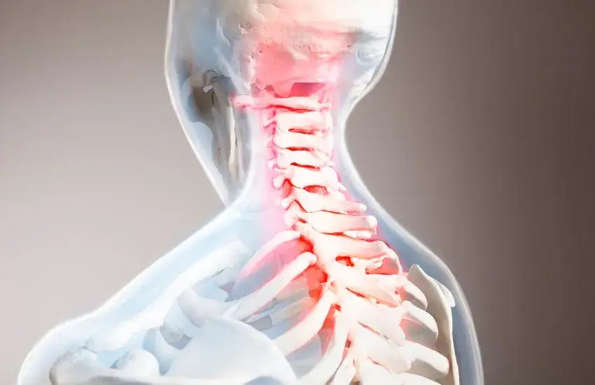 Dolor cervical y meraos laserterapia